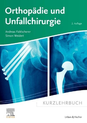 Bild von Kurzlehrbuch Orthopädie und Unfallchirurgie