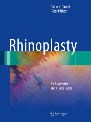 Bild von Rhinoplasty (eBook)