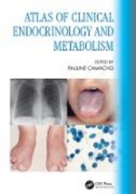 Bild von Atlas of Clinical Endocrinology and Metabolism (eBook)