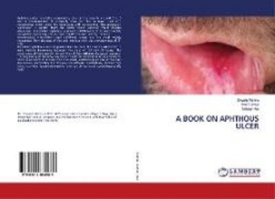 Bild von A BOOK ON APHTHOUS ULCER