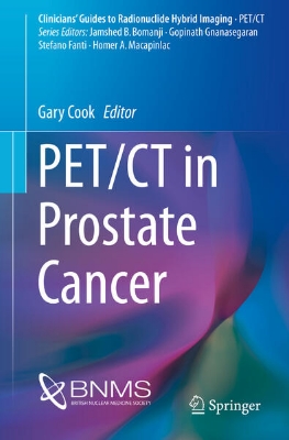 Bild von PET/CT in Prostate Cancer (eBook)