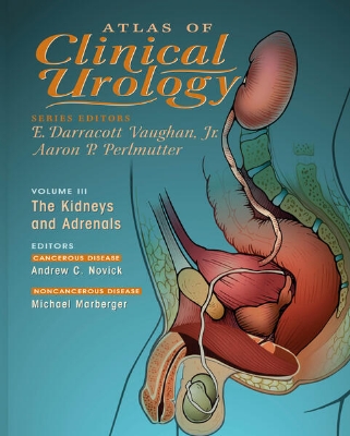 Bild von Atlas of Clinical Urology