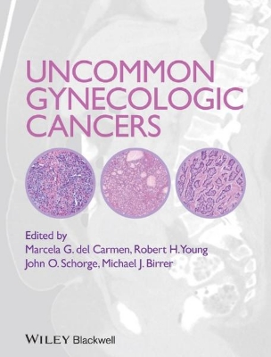 Bild von Uncommon Gynecologic Cancers (eBook)