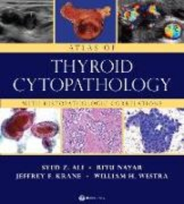 Bild von Atlas of Thyroid Cytopathology