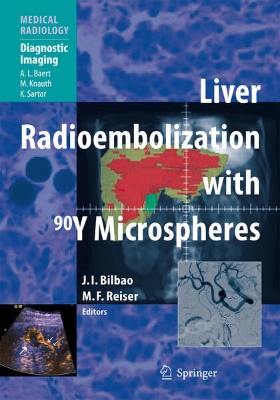 Bild von Liver Radioembolization with 90Y Microspheres (eBook)