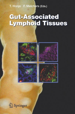 Bild von Gut-Associated Lymphoid Tissues