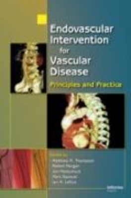 Bild zu Endovascular Intervention for Vascular Disease (eBook)